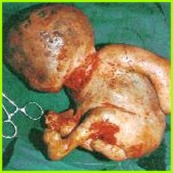 alien baby