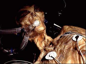 dead alien